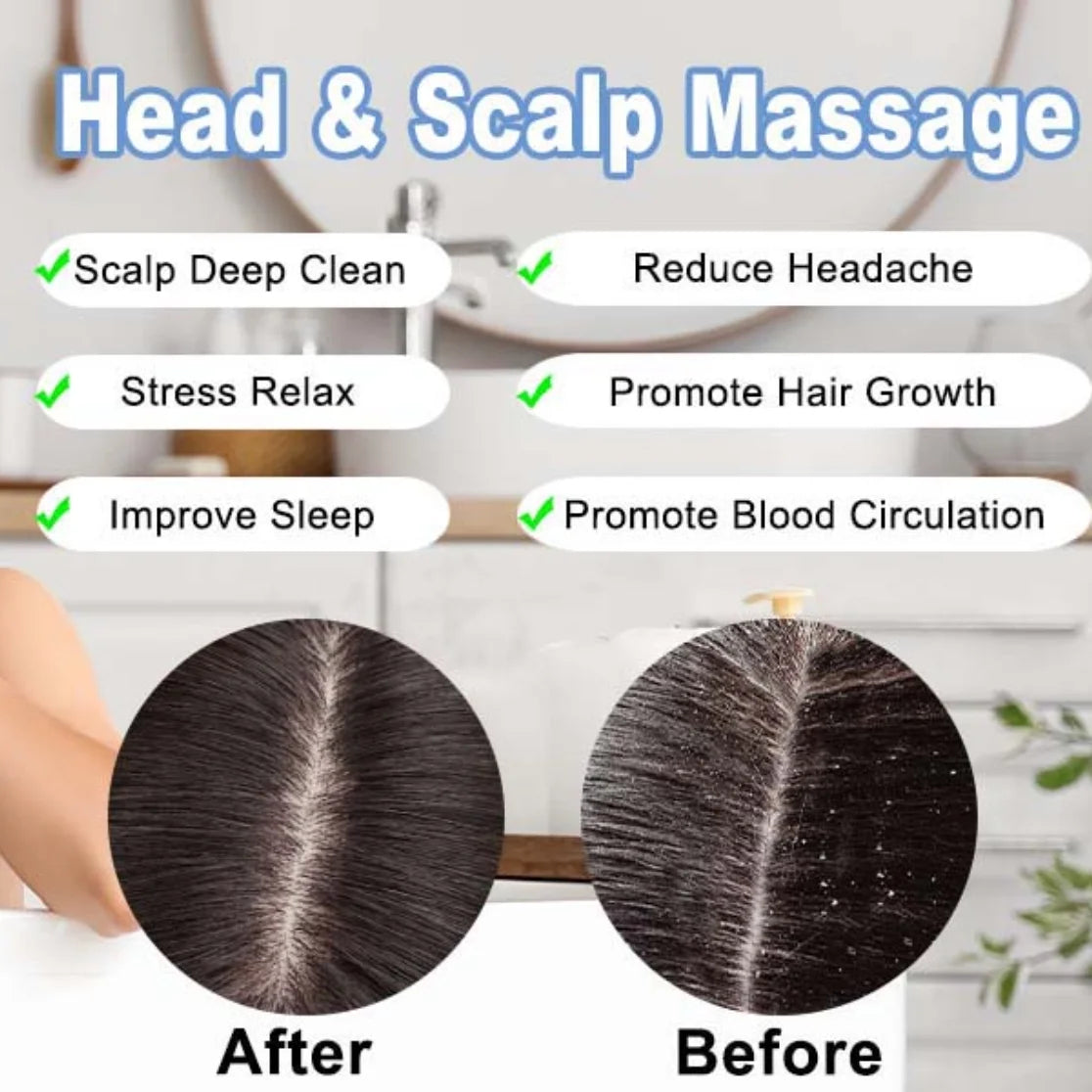 Scalp Massager Hair Growth,Electric Head Massager with 8 Removable Massage Claws Cat Massager(Gold)